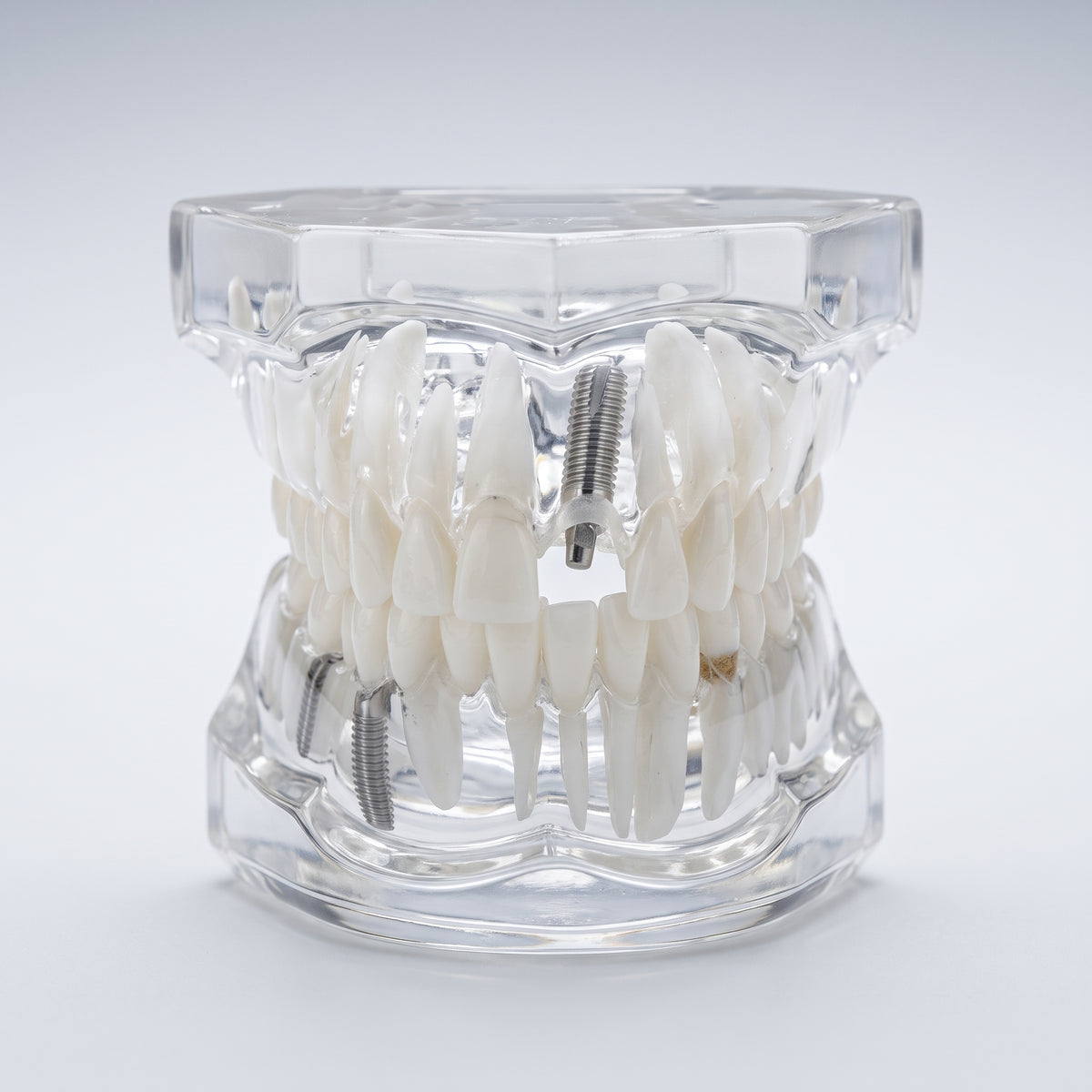 Modèle dentaire transparent 3D Image principale du produit