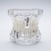 Modèle dentaire transparent 3D