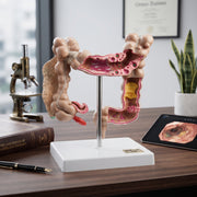 Modèle Anatomique : Gros Intestin Humain